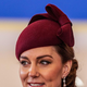 FOTO: Princesa Kate ima na glavi skrivnostno brazgotino, ki je posledica ...