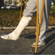 Ukrajinski zdravniki ponujajo storitve lomljenja nog