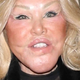 Jocelyn Wildenstein opazili na večerji s 25 let mlajšim zaročencem, njen obraz razpada