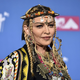 “Zlomljena lutka” Madonna prestala operacijo kolena