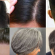 Najnovejša metod, ki obljublja popolno obnovitev las