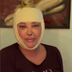 Znana Slovenka se je odločila za operacijo obraza, tako je videti zdaj